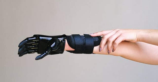 Starfish-Investpad fund piles into bionics firm Makers Hive